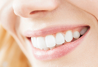 Close up of women smiling and showing her porcelain crowns from Sharokina Eshaghi, DMD 